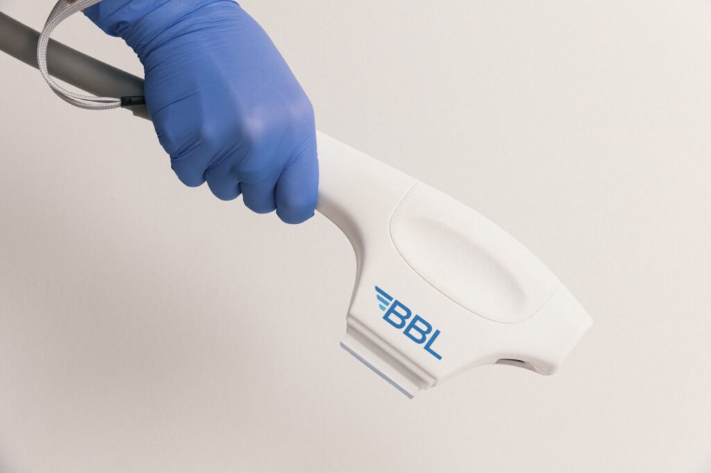 A blue-gloved hand holds the BBL device ready for a BBL facial in Georgetown.